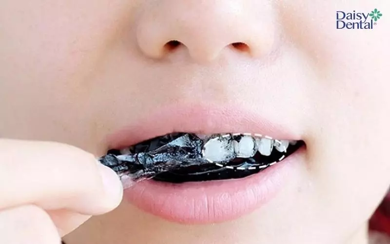 Miếng dán giúp cải thiện màu sắc răng nhanh chóng, hiệu quả